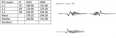 Case Report: Functional Outcome of COVID-19 Subjects With Myasthenia Gravis and Critical Illness Polyneuropathy